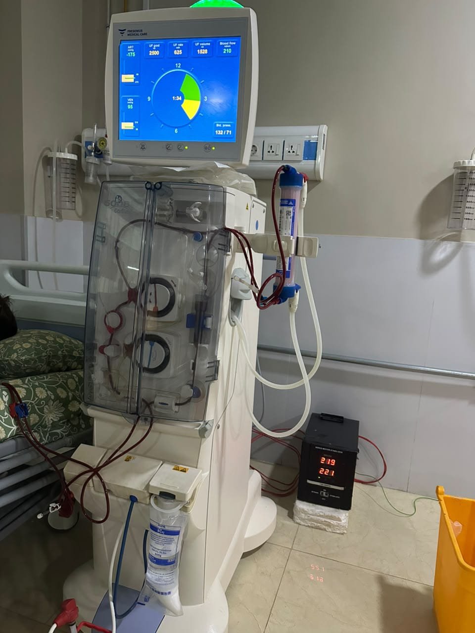 Fresenius HDF Dialysis Machine